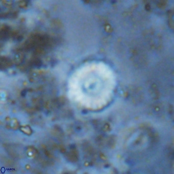 Watznaueria angustoralis VR 12935