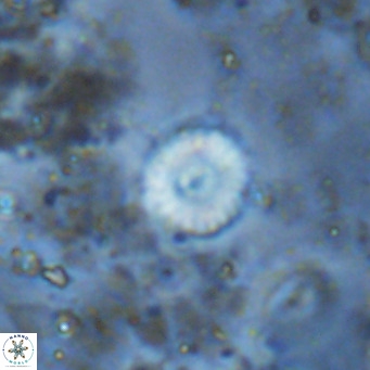 Watznaueria angustoralis VR 12935
