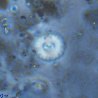 Watznaueria angustoralis VR 12936