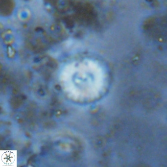 Watznaueria angustoralis VR 12936