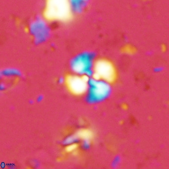 Watznaueria angustoralis VR 14400