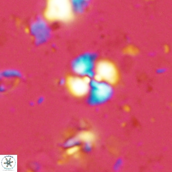 Watznaueria angustoralis VR 14400