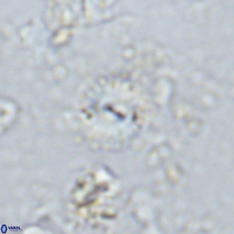 Watznaueria angustoralis VR 14401