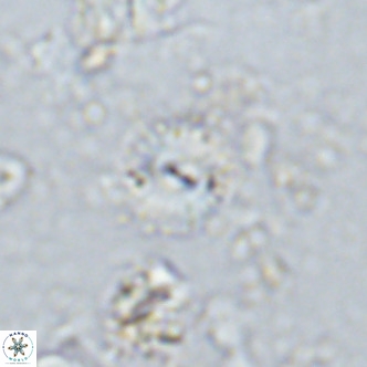 Watznaueria angustoralis VR 14401