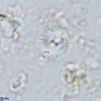 Watznaueria angustoralis VR 14402