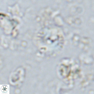 Watznaueria angustoralis VR 14402