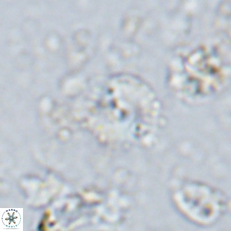 Watznaueria angustoralis VR 14404