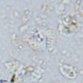 Watznaueria angustoralis VR 14405