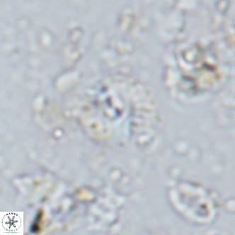 Watznaueria angustoralis VR 14405