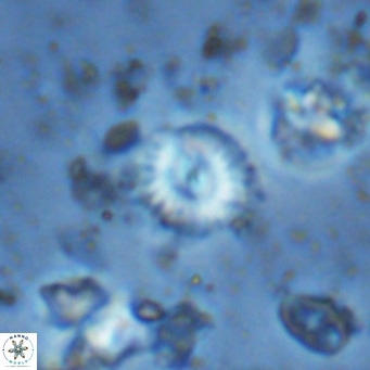 Watznaueria angustoralis VR 14406