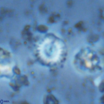 Watznaueria angustoralis VR 14408