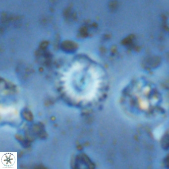 Watznaueria angustoralis VR 14408