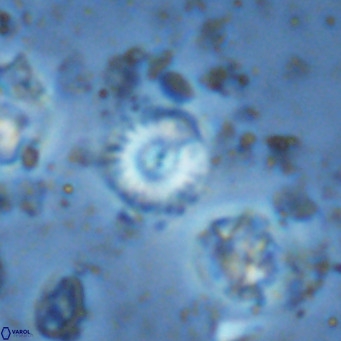 Watznaueria angustoralis VR 14409