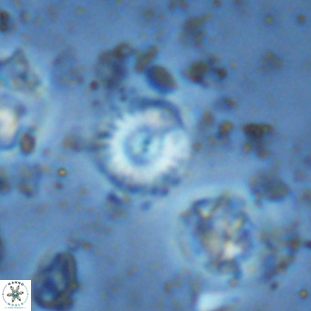 Watznaueria angustoralis VR 14409