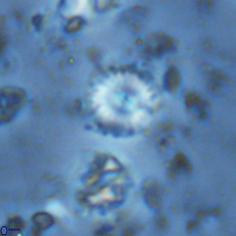 Watznaueria angustoralis VR 14410