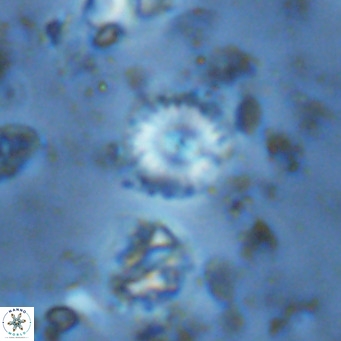 Watznaueria angustoralis VR 14410