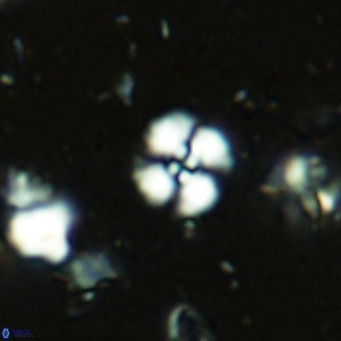 Watznaueria angustoralis VR 14393