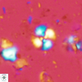 Watznaueria angustoralis VR 14394