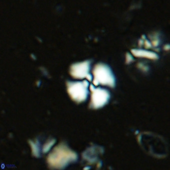 Watznaueria angustoralis VR 14395