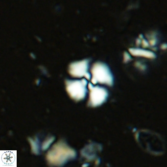 Watznaueria angustoralis VR 14395