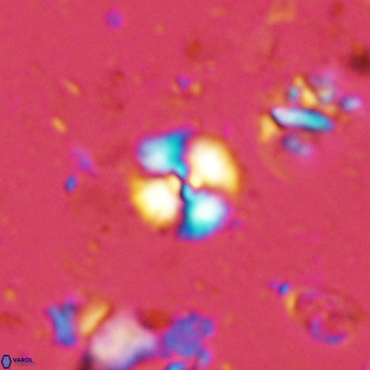 Watznaueria angustoralis VR 14396