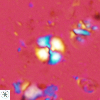 Watznaueria angustoralis VR 14396