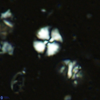 Watznaueria angustoralis VR 14397