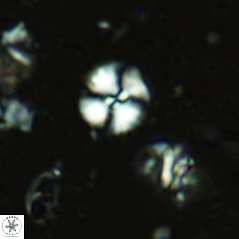 Watznaueria angustoralis VR 14397