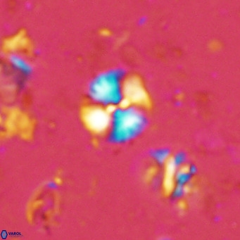 Watznaueria angustoralis VR 14398