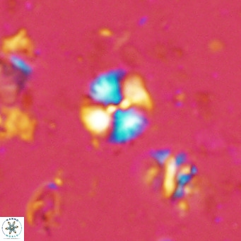 Watznaueria angustoralis VR 14398