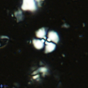 Watznaueria angustoralis VR 14399