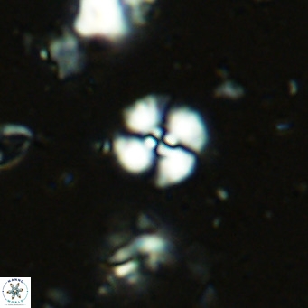 Watznaueria angustoralis VR 14399