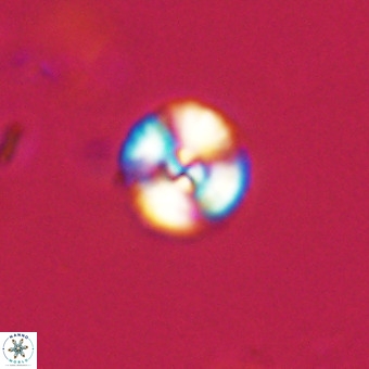 Watznaueria angustoralis VR 23826