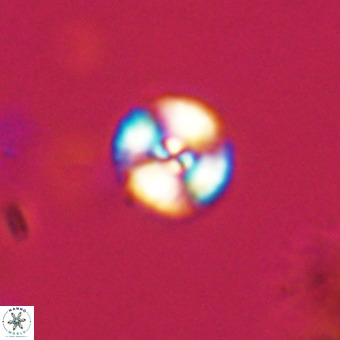 Watznaueria angustoralis VR 23831