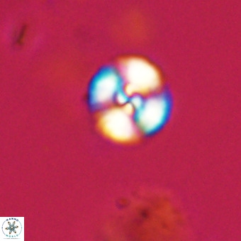 Watznaueria angustoralis VR 23832