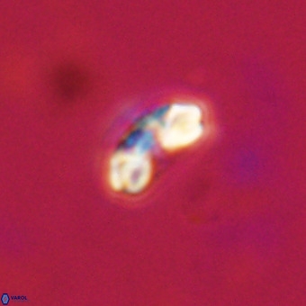 Watznaueria angustoralis VR 23836