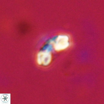 Watznaueria angustoralis VR 23836