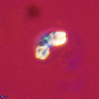 Watznaueria angustoralis VR 23837