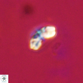 Watznaueria angustoralis VR 23837