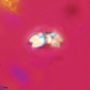 Watznaueria angustoralis VR 23841
