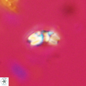 Watznaueria angustoralis VR 23841