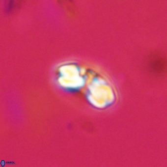 Watznaueria angustoralis VR 23842