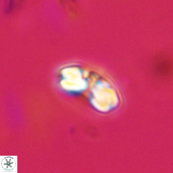 Watznaueria angustoralis VR 23842