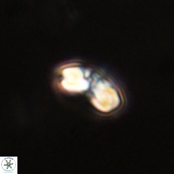 Watznaueria angustoralis VR 23843