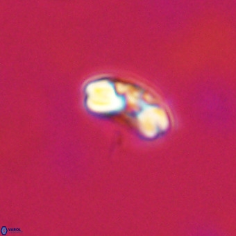 Watznaueria angustoralis VR 23855