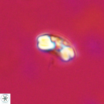 Watznaueria angustoralis VR 23855