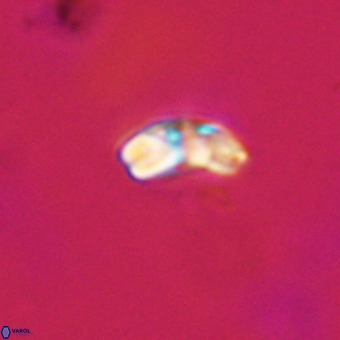 Watznaueria angustoralis VR 23859