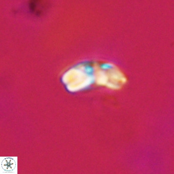 Watznaueria angustoralis VR 23859