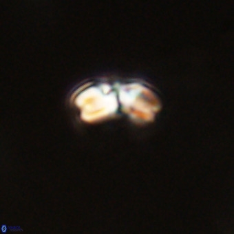 Watznaueria angustoralis VR 23860