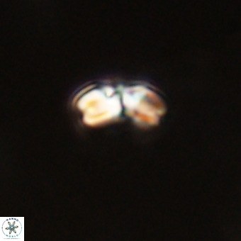 Watznaueria angustoralis VR 23860